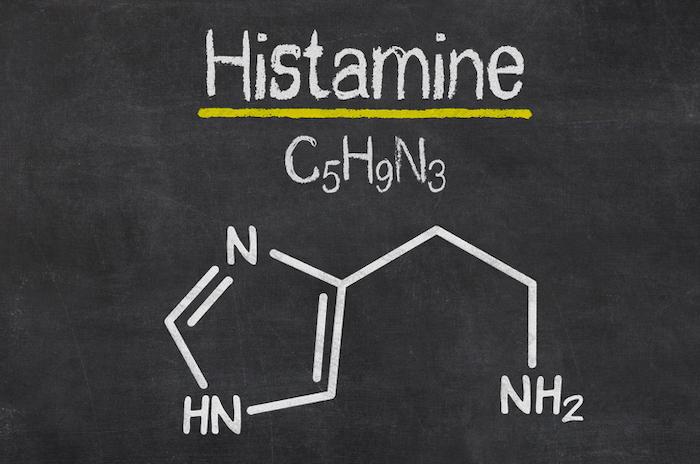 Histaminintoleranz